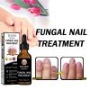 EELHOE Nail Solution Thickening Brightening Nails Removing Gray Nails Dead Skin Nourishing Nail Care Solution